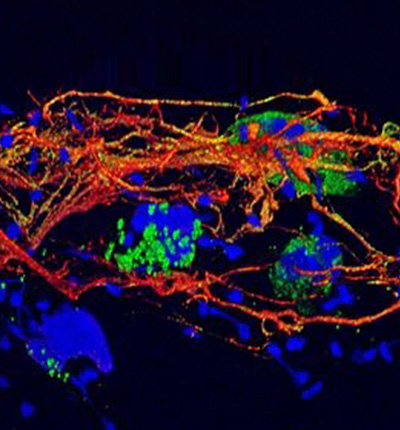 prof-zychlinsky_cellmicrobio.jpg Image Title