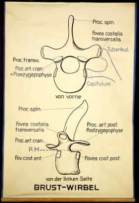 ASk 03 Brust-Wirbel.jpg