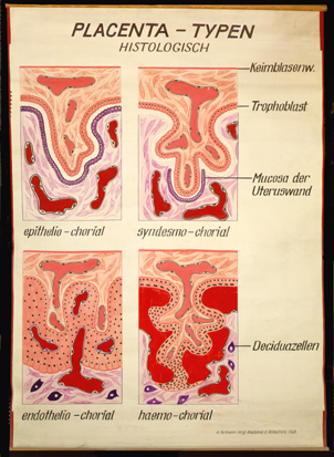 Ont 19 Placenta-Typen, histologisch.jpg
