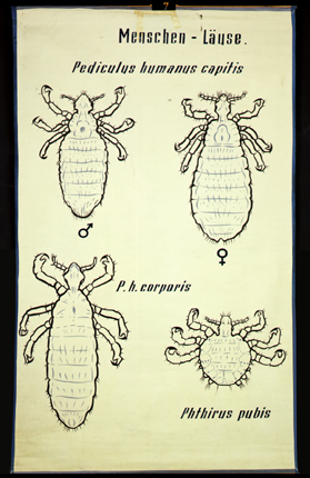 Pt 24 Menschen-Läuse (Pediculus, Phthirus).jpg