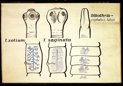 Pl 17-T.solium T.saginata.jpg