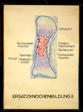 Ske 08 Ersatzknochenbildung II.jpg