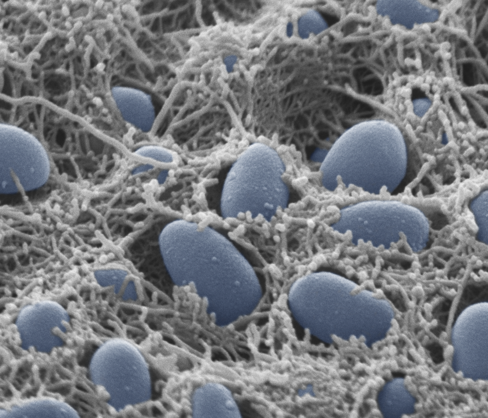 Blue E.coli cells in curli nests