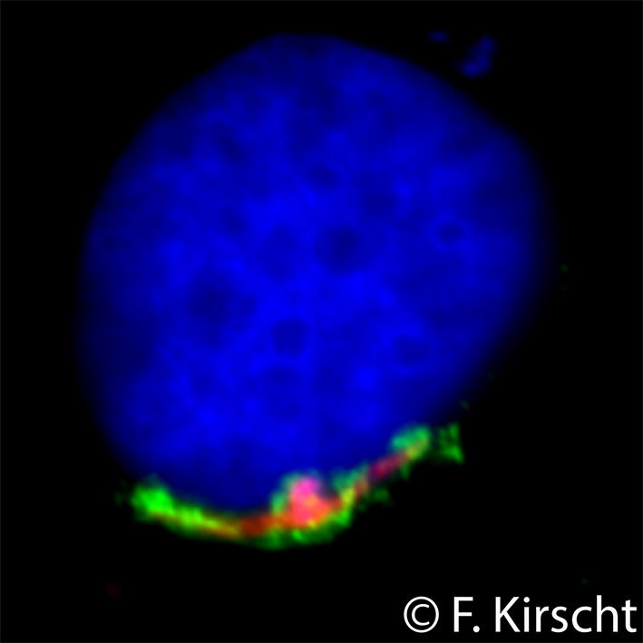 Pic_website plasmodium proteins_Kirscht.jpg