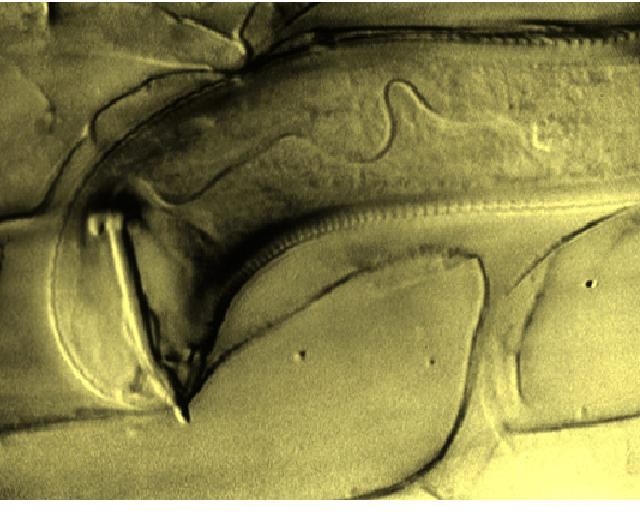 Pratylenchus 2 Pratylenchus