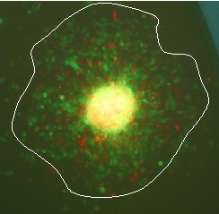 spheroidsMigration