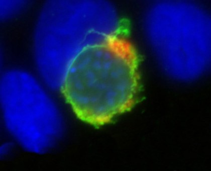 prof-matuschewski-molparasito_plasmod-from-website.jpg