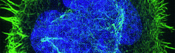 tcell klotsch slider.png